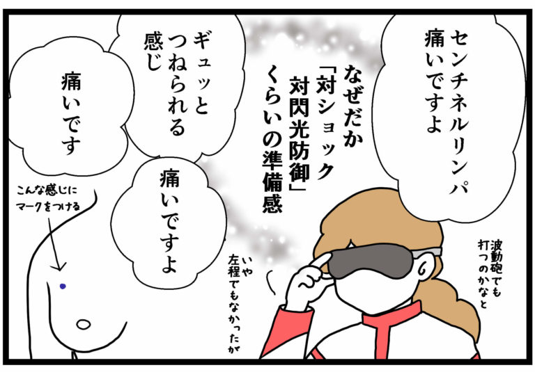 乳房生検の実施方法